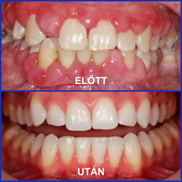 📢📢POPUSTA!!🔥Kupi jedan dobi jedan gratis🔥🦷🐝Rolimey® VioCore Pasta za Zube s Pčelinjim OtrovomZa Čistu i Svježu Usnu Šupljinu💥