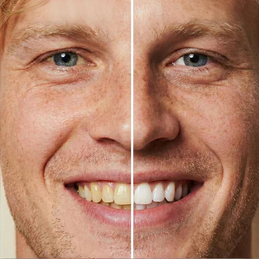 📢📢POPUSTA!!🔥Kupi jedan dobi jedan gratis🔥🌿🪥 Blaga Pasta za Zube – Nježno Čišćenje i Njega Desni💥