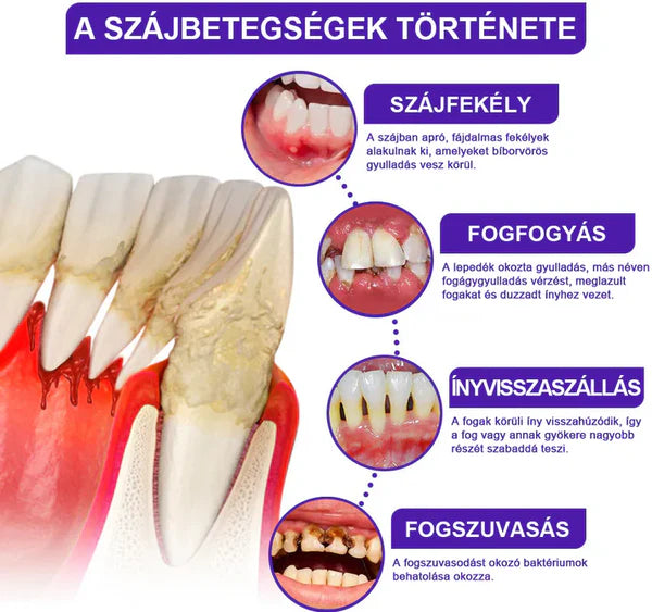 📢📢POPUSTA!!🔥Kupi jedan dobi jedan gratis🔥🦷🐝Rolimey® VioCore Pasta za Zube s Pčelinjim OtrovomZa Čistu i Svježu Usnu Šupljinu💥