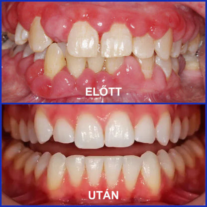 📢📢POPUSTA!!🔥Kupi jedan dobi jedan gratis🔥🦷🐝Rolimey® VioCore Pasta za Zube s Pčelinjim OtrovomZa Čistu i Svježu Usnu Šupljinu💥