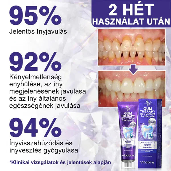 📢📢POPUSTA!!🔥Kupi jedan dobi jedan gratis🔥🦷🐝Rolimey® VioCore Pasta za Zube s Pčelinjim OtrovomZa Čistu i Svježu Usnu Šupljinu💥