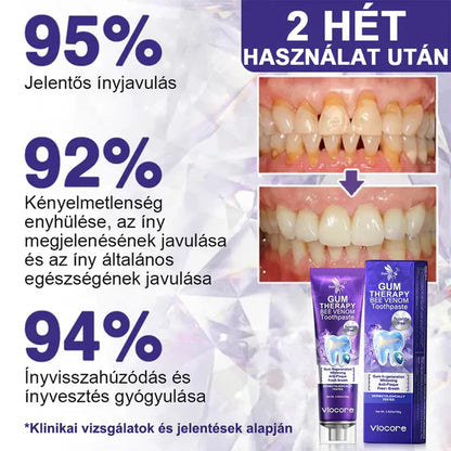 📢📢POPUSTA!!🔥Kupi jedan dobi jedan gratis🔥🦷🐝Rolimey® VioCore Pasta za Zube s Pčelinjim OtrovomZa Čistu i Svježu Usnu Šupljinu💥