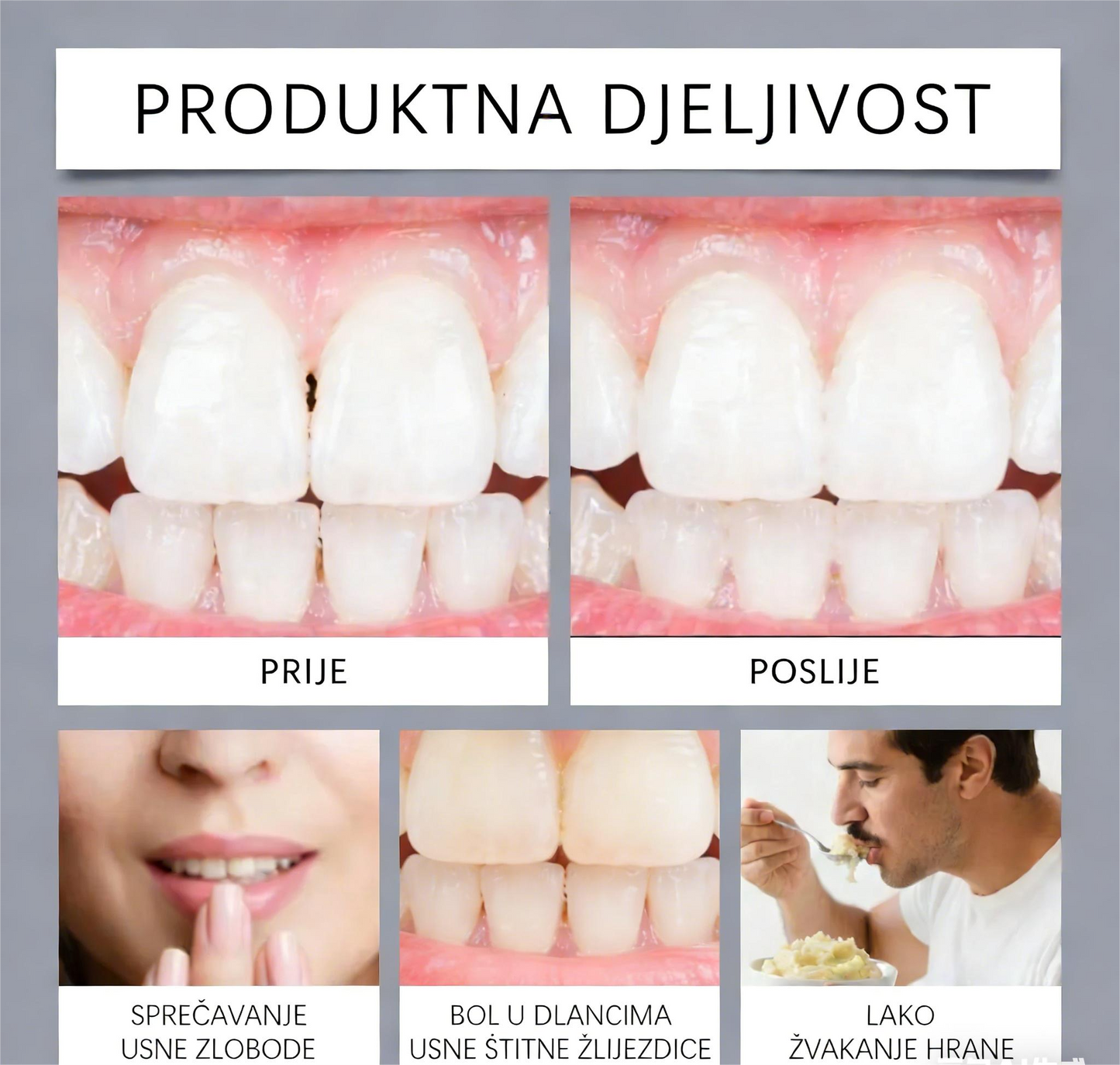 📢📢Kupi jedan dobi jedan gratis🔥POPUSTA!!🔥AdhereDent® Termoplastično ljepilo za proteze ⏳