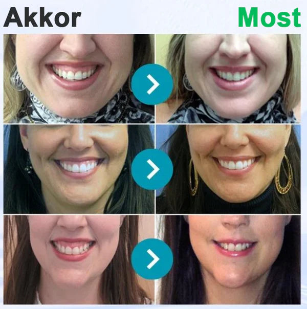 📢📢POPUSTA!!🔥Kupi jedan dobi jedan gratis🔥🦷🐝Rolimey® VioCore Pasta za Zube s Pčelinjim OtrovomZa Čistu i Svježu Usnu Šupljinu💥