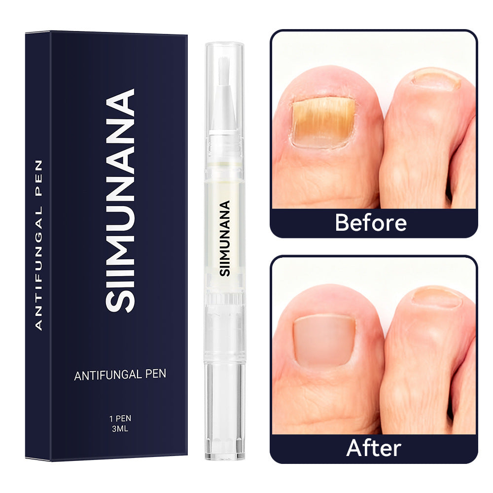 📢📢POPUSTA!!🔥Kupi jedan dobi jedan gratis🔥💅✨ “Tekućina za njegu noktiju”☀️