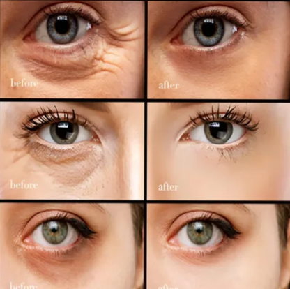 🔥 Super popularni proizvodi 🔥☕ “Krema za područje oko očiju s kofeinom”✨👀