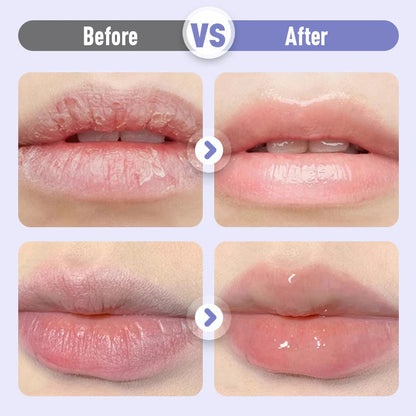 🔥 Super popularni proizvodi 🔥💄💧 Reci zbogom suhim usnama! ✨ Njegujući serum za prirodno sjajne i mekane usne 💋🌸